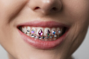 TOOTH JEWELLERY